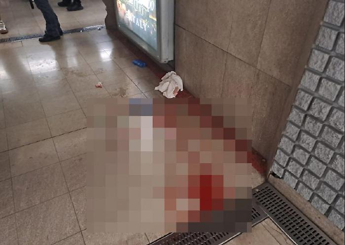 "Che cos&rsquo;hai da guardare. Sono uomo e sono musulmano": e sfregia una ragazza di 23 anni
