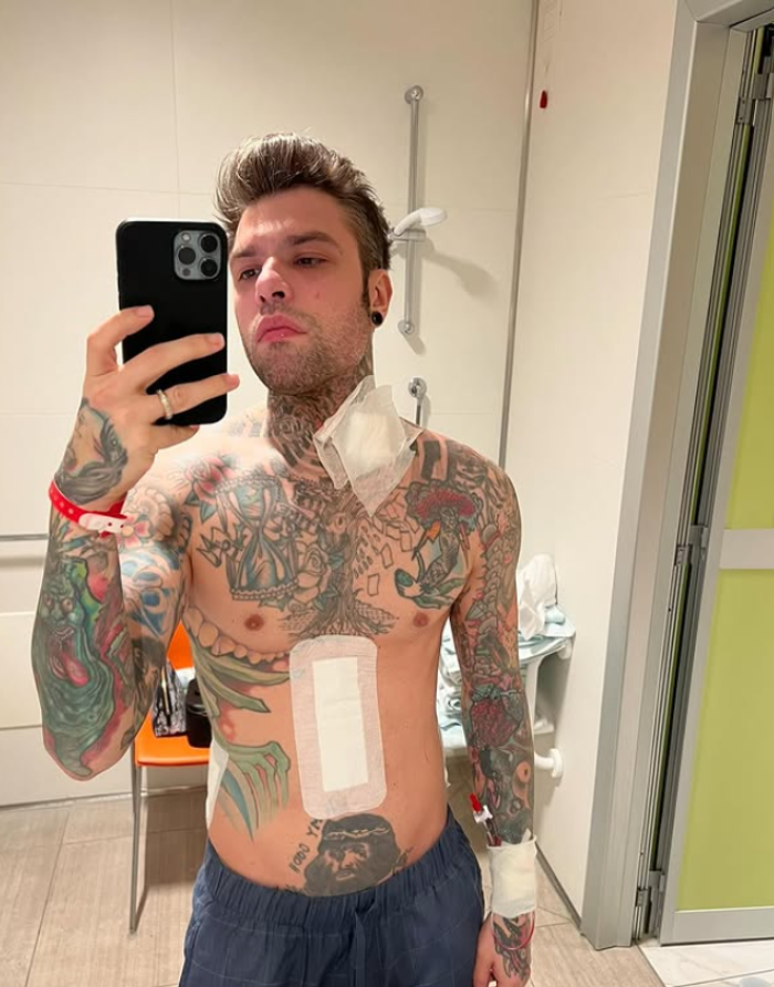 Fedez resta ricoverato: trasferito all'Humanitas di Rozzano